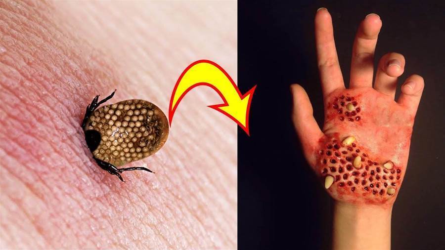 the-most-dangerous-bug-in-the-world-11-deadly-insects-you-want-to